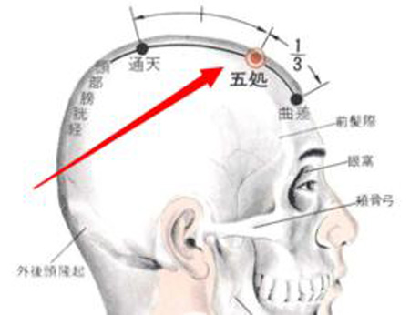 五處穴→清熱散風