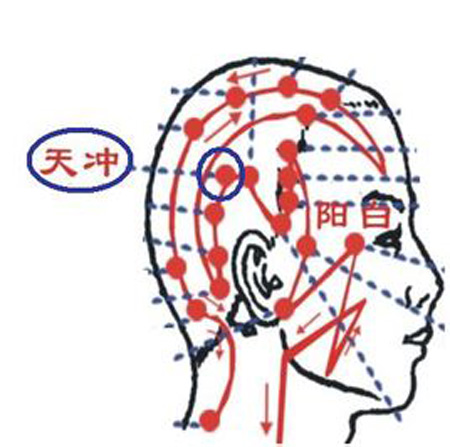 天沖穴→治頭痛、齒痛