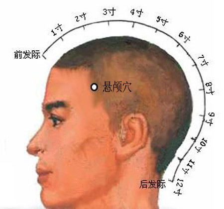 懸顱穴→治偏頭痛、面腫