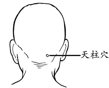 天柱穴→治頭痛、項強