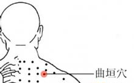 曲垣穴→疏風(fēng)止痛