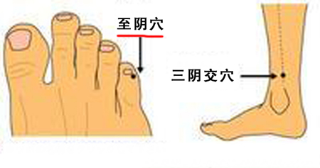 至陰穴→治頭痛、目痛