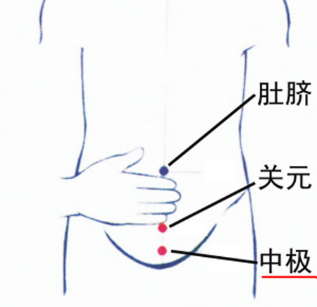 中極穴：補(bǔ)腎培元，調(diào)治陰挺、不孕