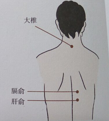 貧血的特色中醫(yī)針灸療法介紹