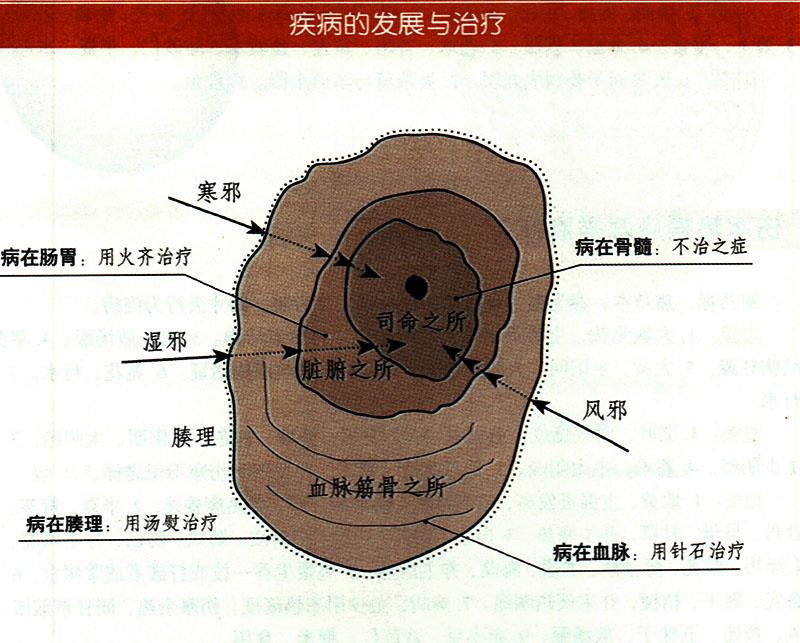 諸氣應(yīng)怎樣治療？