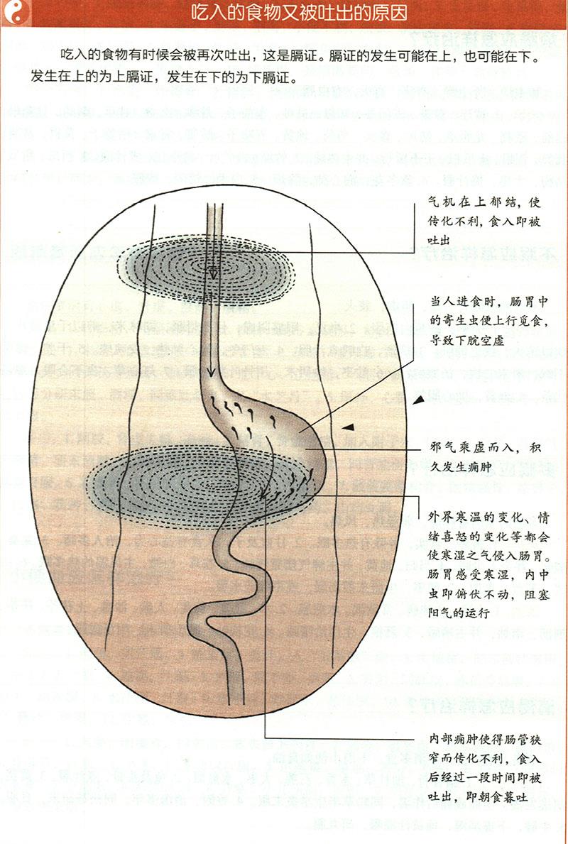 嘔吐應(yīng)怎樣治療？