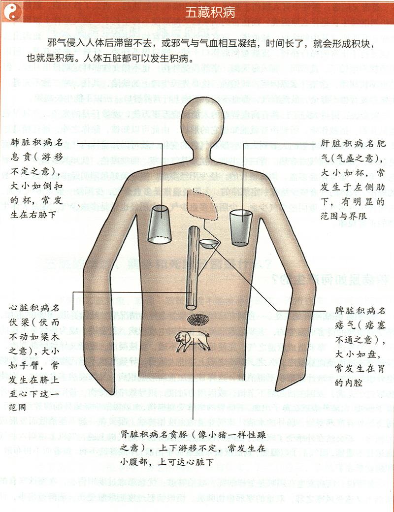 積病是如何產生的？